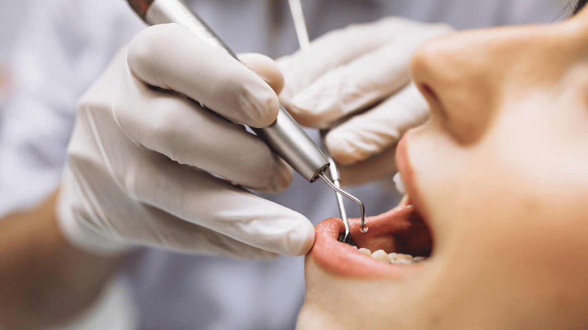 root_canal_banner-1